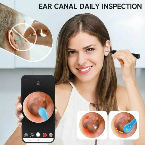 Earwax Remover With Camera - Alt View